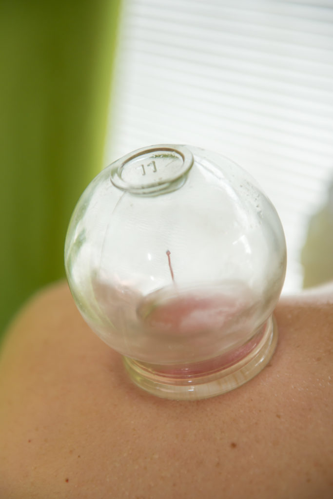 Glass Cupping Jar Set 5 Piece ViVi TherapyViVi Therapy