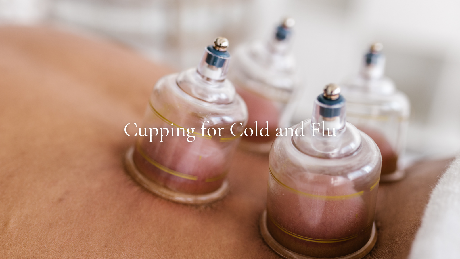 Cupping Therapy on the back