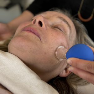 Carmen-Facial-Acu-Pic-7-300x300 Facial Acupuncture